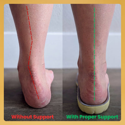 Keloes Comfort Insoles