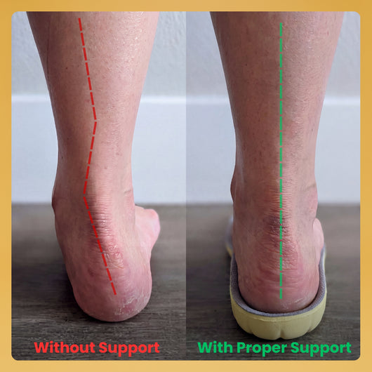Keloes Comfort Insoles